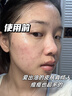 初蔓氨基酸洗面奶男女士控油祛痘除螨虫去黑头深层清洁收缩毛孔洁面乳 【控油净毛孔】B5洁面乳*1支 明星推荐B5洗面奶热销榜TOP 实拍图