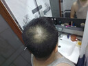 加禾头发纤维喷雾纤维粉视觉增发补发密发际线粉填充秃顶发缝稀疏遮盖 【升级款喷雾】小瓶喷雾黑 实拍图