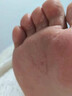 健医师【官方大药房】儿童脚气专用喷雾剂壳聚糖脚轻松除脚臭杀真菌感染 实拍图