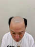 鼎盛摩尔金鼎盛摩尔 假发男发际线男士假发片补头顶隐形秃顶中分无痕补发 AI补发修剪意向金 短发 实拍图