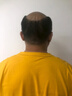 鼎盛摩尔金鼎盛摩尔 假发男发际线男士假发片补头顶隐形秃顶中分无痕补发 AI补发修剪意向金 短发 实拍图