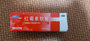 福元 红霉素软膏 用于脓疱疮等化脓性皮肤病、溃疡面的感染和寻常痤疮yp 1盒 实拍图