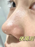 沃朗森医用清洁泥膜面膜深层清洁去黑头闭口收缩毛孔美白保湿去黄提亮 实拍图