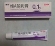 丽芙维A酸乳膏0.1%*18g+10%尿素乳膏30g*2去祛痘药膏医用淡化痘印黑头去鸡皮肤黑色素可搭异维A酸凝胶囊 实拍图