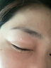 碧素堂脂肪粒去除药膏去除神器眼周专用去小颗粒油去眼霜眼部 3支【消除颗粒】重度脂肪粒适用 药房直售【院线专研】 实拍图