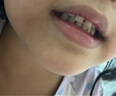 高露洁（Colgate）细毛护龈备长炭软毛成人牙刷12支家庭装款式颜色随机发货京东自营 实拍图