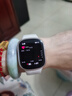荣耀手表4支持eSIM独立通话智能电话10天长续航运动睡眠血氧监测成人男女士时尚运动方形手表 金色表框【含晨曦金表带】 实拍图