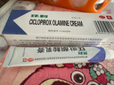 环利环吡酮胺乳膏1%*20g*1盒适用于浅部皮肤真菌感染体股癣手足癣花斑癣皮肤念珠菌病甲癣。 实拍图