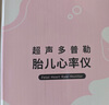 邦力健胎心仪 胎心监测仪医用监护仪孕妇家用超声多普勒胎儿心率仪U2-02 实拍图