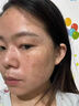 日本新薬株式会社【皮肤科医用】去老年斑专用的可搭药膏脸部一夜消手部除祛斑霜BD 送医用棉签【两盒优惠装】第二盒半价（小面积斑） 实拍图