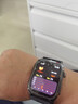 辰芝血压血糖监测手表二类医疗器械认证手表气泵式血脂尿酸监测手环 星耀黑  医疗级ECG蓝牙通话款高精度监测 WATCH 12 华为鸿蒙苹果ios安卓通用 实拍图