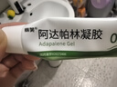 丽芙甲硝唑凝胶30g+阿达帕林凝胶35g甲硝锉凝胶祛痘印修复淡化痘印痘坑修复药膏 实拍图