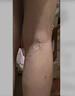 本安制药医用静脉曲张专用非膏药贴冷敷凝胶蚯蚓腿血管堵塞疏通可搭弹力袜 实拍图