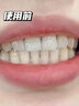 倾姿堂美白牙膏去口臭去黄去牙结石去牙渍牙垢护龈固齿清新口气100g 实拍图