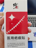 修正医用硅酮疤痕贴减张贴器刨剖腹产去祛疤膏儿童专用修复凝胶除疤膏 实拍图