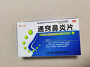普林松 通窍鼻炎片12片*4板/盒 过敏性鼻炎慢性鼻炎鼻塞鼻窦炎流涕 实拍图