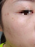维特丝愈创木祛痘精华控油修护保湿淡化痘印去痘痘收缩毛孔男女士护肤品 实拍图