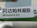 丽芙阿帕林凝胶16g+甲硝唑锉凝胶20g+B5舒缓保湿乳50g去黑头修复毛孔收缩毛孔粗大 实拍图