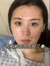 美迪惠尔美迪惠尔积雪草精华舒缓保湿修复提亮控油抗痘收毛孔40ml 80g 积雪草精华40+40ml 实拍图