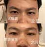 眼袋去除神器眼霜去大眼袋严重中老年男女士专用消除黑眼圈精华油 一盒眼贴【20贴】 实拍图