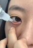 远清眼药水消炎止痒杀菌干涩发痒红血丝疲劳眼干眼涩视力模糊缓解眼疲劳熬夜玩手机用眼过度硫酸锌尿囊素滴眼液 1盒医用海露润干眼症花粉过敏结膜炎眼睛发痒角 实拍图