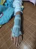 中量医用腕关节固定支具儿童前臂骨折固定护具手腕桡骨远端夹板腕部 儿童款左+肩带 实拍图