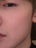 维特丝愈创木祛痘精华控油修护保湿淡化痘印去痘痘收缩毛孔男女士护肤品 实拍图