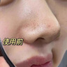 沃朗森医用清洁泥膜面膜深层清洁去黑头闭口收缩毛孔美白保湿去黄提亮 实拍图