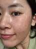 卡尼尔泰国原装进口防晒霜祛斑美白精华消除晒斑晒伤去痘印护肤品套装 实拍图