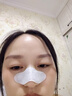 时珍世家金系列鼻炎贴鼻炎鼻贴苍耳子鼻窦炎鼻塞通鼻过敏性鼻敏通气鼻贴儿童成人 实拍图