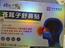 时珍世家金系列鼻炎贴鼻炎鼻贴苍耳子鼻窦炎鼻塞通鼻过敏性鼻敏通气鼻贴儿童成人 实拍图