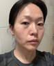 骑舰士微针微晶导入仪水光机针自打仪器全套家用纳米原液头皮米诺地尔 7代自动出液+10耗材 【脸部颈部】 实拍图