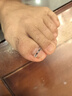 脚医生嵌甲贴片配嵌甲钳甲沟炎矫正器专用正甲贴片脚趾甲长肉里 实拍图