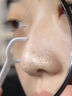 沃朗森医用清洁泥膜面膜深层清洁去黑头闭口收缩毛孔美白保湿去黄提亮 实拍图