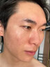 代文脸上坑坑洼洼痘坑痘印痘疤男士凹洞凹陷疤痕可搭祛痘修复凝胶CN 【2盒】建议三盒以上使用 实拍图