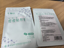 云南白药泰邦痘痘贴型创口贴 轻薄透气皮外伤轻薄服帖不卷边 45粒/袋  实拍图