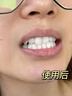 韩方五谷酵素牙膏美白牙亮口臭清新口气护龈结石去渍黄牙垢金榜第一紫150g 实拍图
