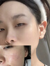 维特丝氨基酸洗面奶男女士控油祛痘深层清洁黑头粉刺水杨酸洁面乳第1名 实拍图