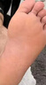 香港大药房有限公司真菌王手足癣感染皮炎湿疹脚气止瘙痒脱皮烂脚丫皮肤用抗藥抑膏 实拍图