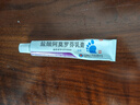 楚迪盐酸阿莫罗芬乳膏20g治脚气药止痒脱皮烂脚丫真菌感染自营去脚气软膏脚出汗脚臭专用药水泡型 实拍图