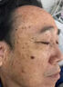 东田老年斑专用的膏药一夜消脸部手背祛斑专用霜去老人斑强力除男士液 【1盒装】特效膏 美白祛斑霜淡化黑色素黄褐斑雀斑晒斑女士用的中药 实拍图