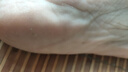 香港大药房有限公司真菌王手足癣感染皮炎湿疹脚气止瘙痒脱皮烂脚丫皮肤用抗藥抑膏 实拍图