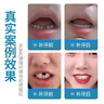 健医师补牙齿神器材料永久自己在家补牙洞填充剂医用树脂修复液高硬度假牙科模型材料30g 实拍图
