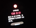 小米（MI）REDMI Watch 5 皎月银 澎湃OS 2 心率血氧监测 蓝牙通话 红米手表5 智能手表 小米汽车 实拍图