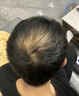 FOR BECARED ONE生物素防脱发维b族b7维生素h白发丝变黑发专用正品b6生发锯棕榈片 专攻雄性脱发/脂溢性脱发】维生素B6+生物素 1瓶*1瓶 实拍图