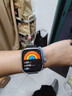 小米（MI）REDMI Watch 5 典雅黑 国家补贴 澎湃OS 2 心率血氧监测 蓝牙通话 红米手表5 智能手表 小米汽车 实拍图