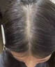 维特丝（vetes）育发液防脱发育发浓密增长液生发剂固发增长密男女头皮护理精华液 实拍图