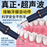 胖猫超声波洁牙器便携洗牙器牙结石去除神器大功率清理黑烟渍黄垢电动冲牙器医家用机高频剔磨牙齿工具 星河蓝丨3个头+便携盒+多用挂架+口腔镜+小工具 实拍图