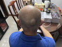 Gerllo德国自助理发器理发神器 自理发器电推剪剃头推子男士自己理寸头 黑色 实拍图