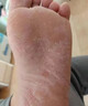 黄锡祥脚气喷雾剂药止痒脱皮烂脚丫真菌感染除脚臭汗脚克星根治可搭软膏 实拍图